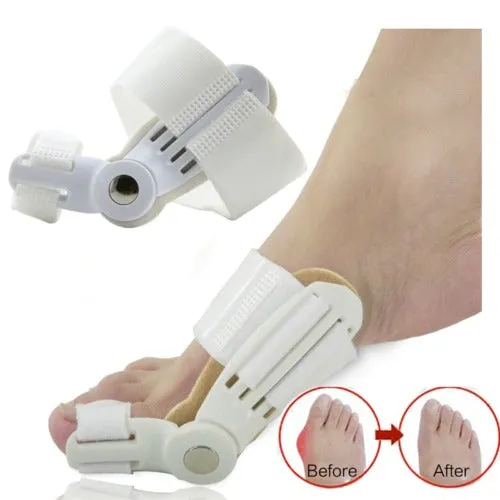 Big Bone Toe Bunion Splint Toe Straightener Corrector De Juanete Foot Pain Relief Hallux Valgus Correction Orthopedic Supplies