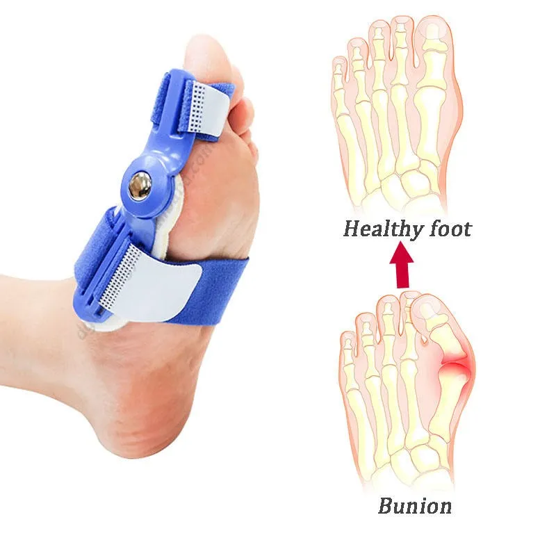 Big Bone Toe Bunion Splint Toe Straightener Corrector De Juanete Foot Pain Relief Hallux Valgus Correction Orthopedic Supplies